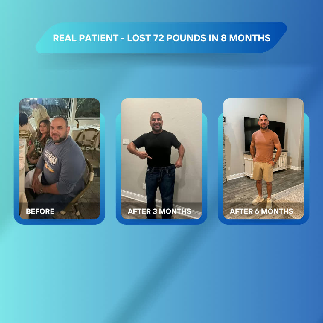 Real Z Med Clinic patient who lost 72 pounds in 8 months, shown before, after 3 months and after 6 months